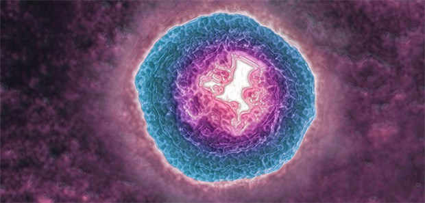 Bearbeite Aufnahme eines Varizella-Zoster-Virus: Die bekommen Ärzte Zoster-Patienten häufig zu Gesicht.