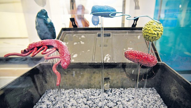 Die Plagen der Welt - Eine Exkursion Bedrohung aus dem Wasser: In einem Untersuchungs-Koffer aus der Zeit Robert Kochs sind Modelle von Krankheitserregern zu sehen