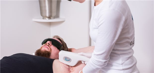 Versorgungskonzept für Patienten Akne inversa Gewinner bei Digi Derma Behandlung eines Patienten mit Akne inversa nach dem Konzept des Unternehmens LENICURA (Symbolbild mit Fotomodell). Die Behandlung mit dem Gerät wird kombiniert mit einer web-basierten Plattform, auf der Patienten den Behandlungsverlauf mitverfolgen können.
