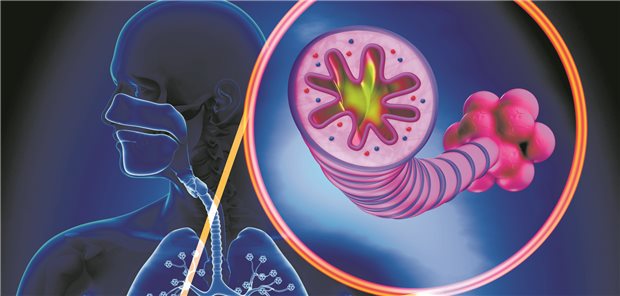Bei COPD gibt es nicht nur Emphysem-Patienten und solche mit chronischer Bronchitis.