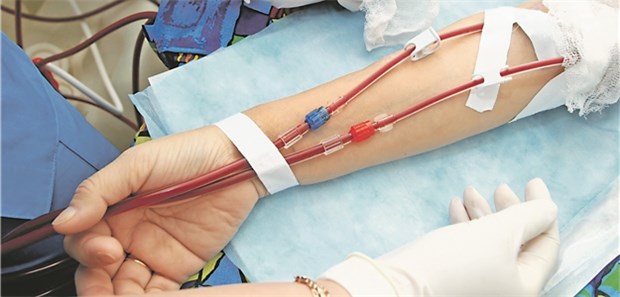 Antikoagulieren oder nicht bei Nierenproblemen? Bei Dialyse-Patienten ist Vorhofflimmern häufig.