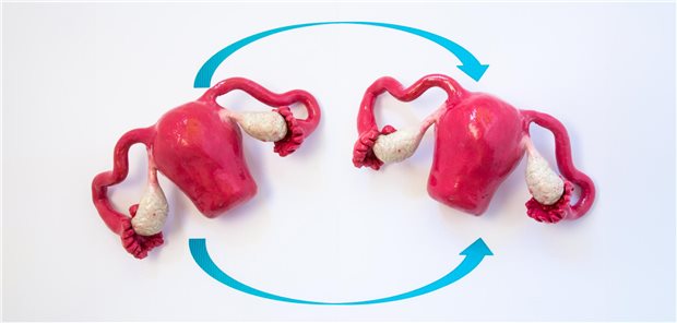 Bei Frauen mit absoluter Uterusfaktor-Infertilität ist eine Uterustransplantation inzwischen technisch möglich.