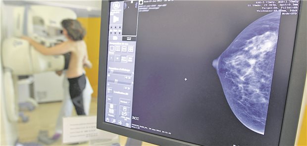 Bei Frauen zwischen 50 und 69 Jahren sollte regelmäßig ein Brustkrebs-Screening durchgeführt werden. Das IQWiG empfiehlt nun, auch jüngere und ältere Frauen einzubeziehen. 