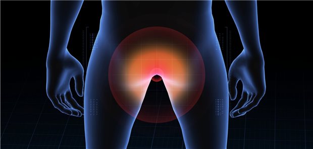 Bei HIV-Patienten mit Anogenitalwarzen ist das Risiko für ein Analkarzinom erhöht. Vor allem ein CD4-Nadir Textbaustein: Mathematik/Kleiner 200/Textbaustein: Griechisch/griml erhöhte das Krebsrisiko.