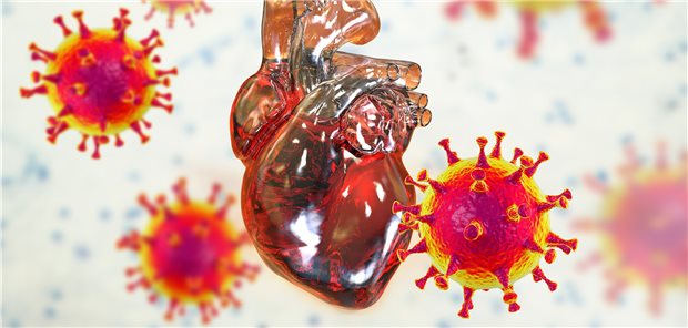 Bei Herzinfarkt plus COVID hatten geimpfte Patienten einer aktuellen Studie zufolge bessere Karten: Sie erlitten seltener respiratorische Komplikationen als die nicht gegen COVID-19 geimpften. Und keiner der geimpften Patienten war im Krankenhaus gestorben.