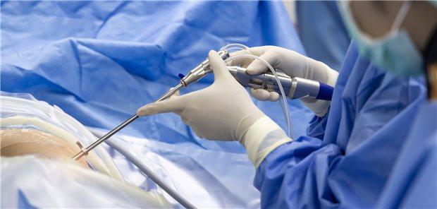 Bei Ischiasbeschwerden, die durch vorgefallenes Bandscheibenmaterial hervorgerufen werden, kann – unter bestimmten Bedingungen – eine operative Therapie von Vorteil sein.&#xA;