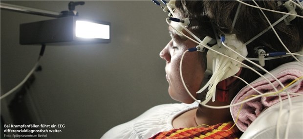Krämpfe - aber keine Epilepsie Bei Krampfanfällen führt ein EEG differenzialdiagnostisch weiter.