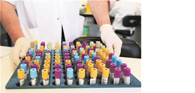 Bei Laboruntersuchungen geben Ärzte die Kennnummern jetzt nicht mehr auf dem Überweisungsschein an, sondern nur noch in der Abrechnung.