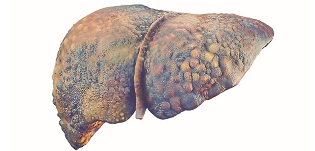 Bei Lebererkrankungen sind Statine kontraindiziert.