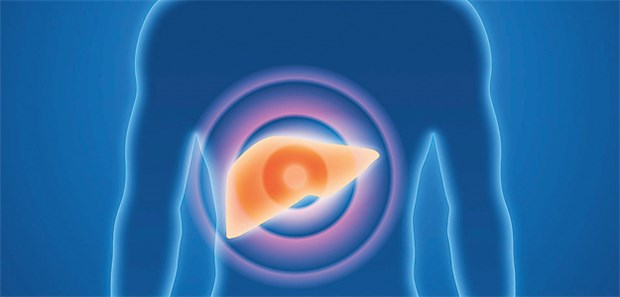 Bei Leberkrebs auf der Basis von exzessivem Alkoholkonsum wird seltener kurativ behandelt.