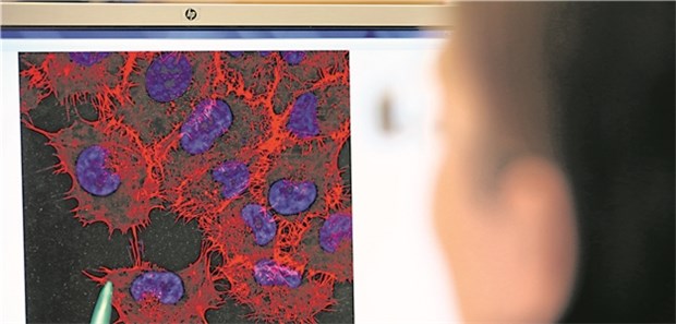 Bei Melanom-Patienten ist die klinisch-pathologische Einschätzung maßgeblich für die Therapiewahl.