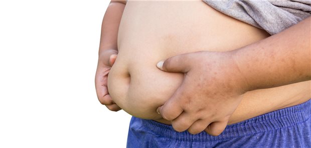 Bei Menschen mit Adipositas, aber ohne Diabetes, waren GLP-1-Rezeptoragonisten in einem systematischen Review sicher und effektiv.