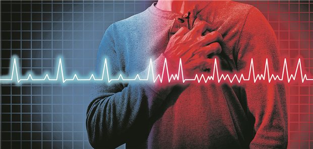 Eine Person greift sich an die Brust. Davor ist die Linie eines EKGs zu sehen, welches ab der Mitte unregelmäßig wird. 