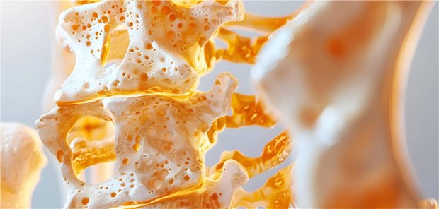 Bei Menschen mit entzündlich-rheumatischen Erkrankungen (iRMD) ist es mit Blick auf die Knochengesundheit wichtig, sowohl die Kontrolle der Krankheitsaktivität, als auch die Glukokortikoid (GC)-Dosis zu optimieren.