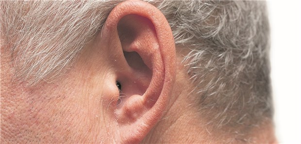 Bei Morbus Menière handelt es sich um eine hydropische Innenohrerkrankung, die primär oder sekundär in Erscheinung tritt.