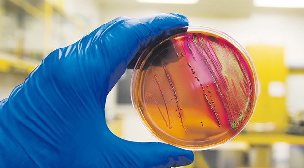 Rösler sieht bei resistenten Keimen Handlungsbedarf Bei Nachweis von MRSA im Labor besteht Meldepflicht.