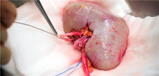 Bei Nierenspendern sollte nach der Operation der GFR sorgfältig überwacht werden.