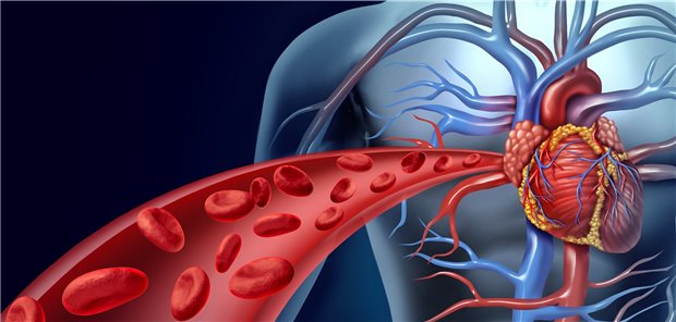 Bei PAVK ist das Risiko für periphere, aber auch für koronare und/oder zerebrovaskuläre Komplikationen erhöht.