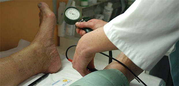 Neue Behandlungsleitlinien für die PAVK Bei Patienten mit PAVK wird empfohlen, nicht nur den Knöchel-Arm-Index im Auge zu behalten, sondern auch auf kardiale Symptome zu achten.