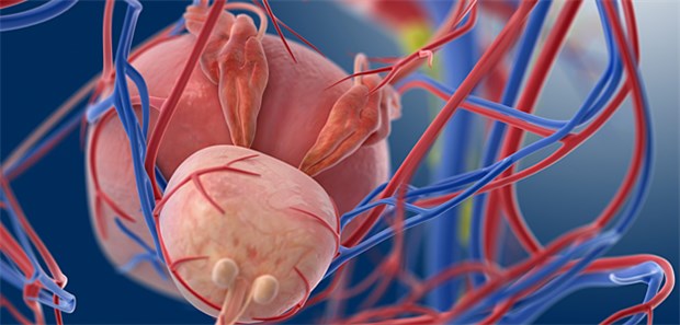 Prostatakarzinom – Erhöhte Krebsgefahr nach Bestrahlung? Bei Patienten mit alleiniger Radiatio ergab sich in der Studie eine1,7-fach höhere Inzidenz für Lungen- und Rektalkarzinome.