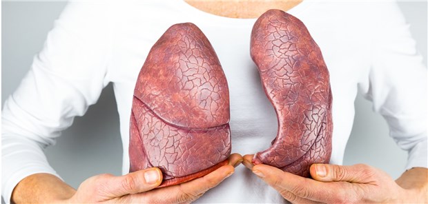 Bei Patienten mit systemischer Sklerose ist häufig auch die Lunge betroffen.