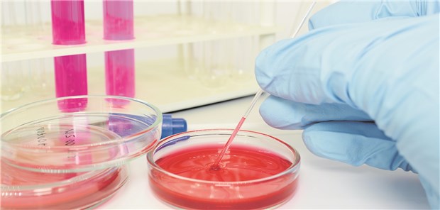 Bei Patientinnen, bei denen die Leukozytenzahl im Urin stark steigt, empfehlen die Ärzte eine Urinkultur.