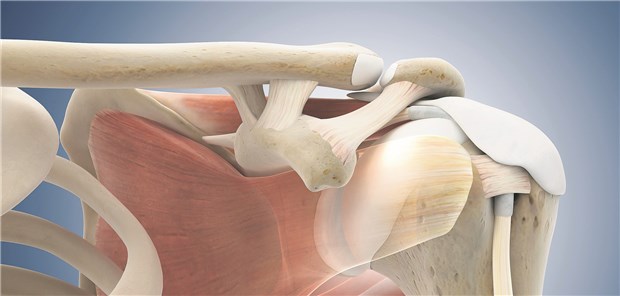 Bei Verletzungen der Rotatorenmanschette operieren oder konservativ behandeln? – Diese Frage gilt es, mit den Patienten zu klären.