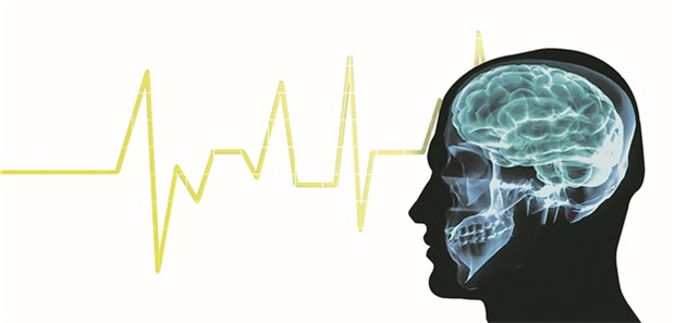 Bei Vorhofflimmern könnten Mikroembolien, die zu sehr kleinen Hirninfarkten führen, kognitive Defizite begünstigen.