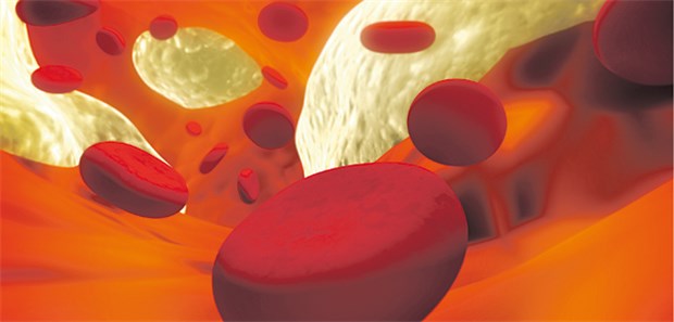 Polypharmazie gefährdet Ältere Bei älteren Patienten mit Polypharmazie inklusive Antikogulation kann das Blutungsrisikoerhöht sein.