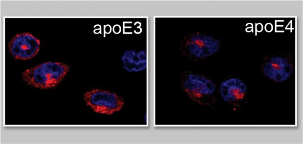 Was ApoE4 fürs Gehirn gefährlich macht Bei apoE3-Bindung kann der Rezeptor Sortilin (rot) an die Zelloberfläche gelangen. Die Bindung von apoE4 verklumpt ihn im Innern der Zelle. Er wird funktionslos.