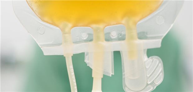 therapeutischer Plasmaaustausch (Plasmaseparation)  bei Rheumapatienten