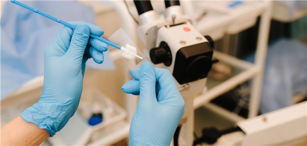 Gynäkologe bereitet einen Vaginalabstrich, der Teil des Zervixkarzinom-Screenings ist, vor.