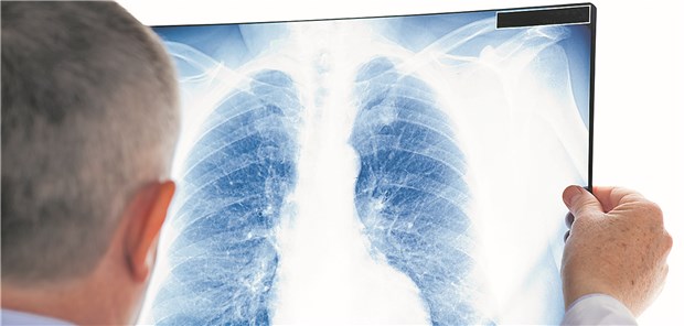 Radiologen stechen Künstliche Intelligenz aus Bei der Interpretation eines Röntgenbildes ist der Radiologe dem Computerprogramm immer noch überlegen.