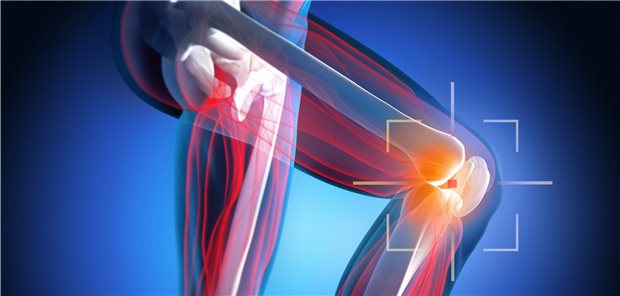 Bei der Knie-Totalendoprothese gibt es einiges zu beachten, mahnt ein Orthopäde.
