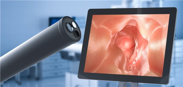 Bei der Koloskopie keine entzündlichen Mukosa-Veränderungen zu entdecken - auf das Ziel der endoskopischen Remission konzentrieren sich Gastroenterologen bis auf Weiteres.