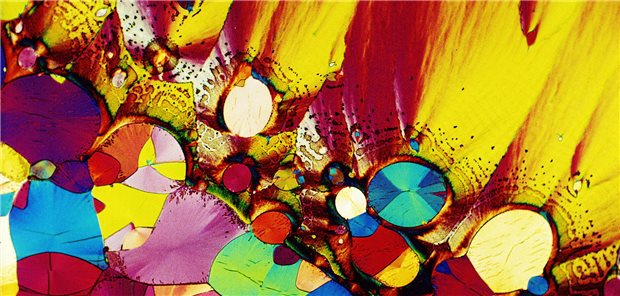 Therapie mit Antidepressiva: Auf die Nebenwirkungen kommt es an Serotoninkristalle, die ein Muster ergeben.