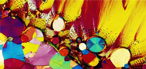 Therapie mit Antidepressiva: Auf die Nebenwirkungen kommt es an Serotoninkristalle, die ein Muster ergeben.