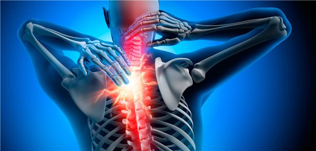 Symbolbild Nackenschmerzen