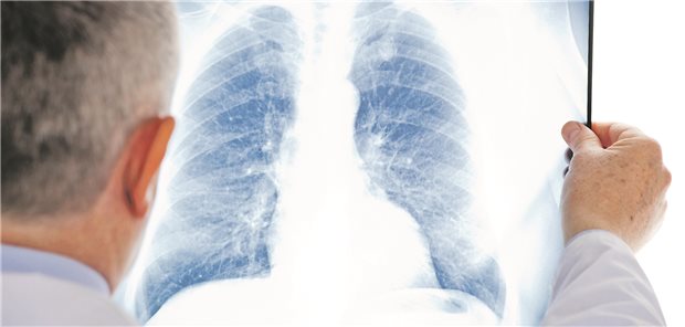 Bei einer Pneumonie können Prognosemarker helfen, Über- und Untertherapien zu vermeiden.