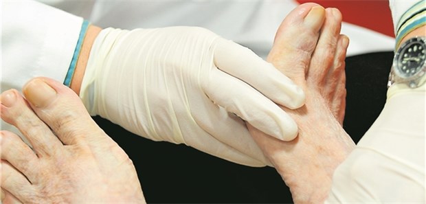 Bei einer diabetischen Neuropathie ist häufig die untere Extremität betroffen.