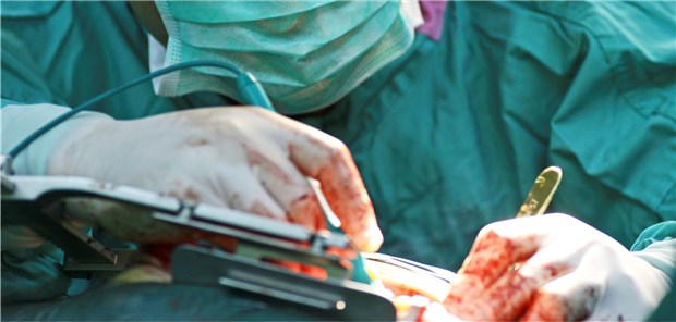 Bei einer radikalen Prostatektomie empfiehlt es sich, den Harnröhrenstumpf möglichst lang zu lassen.