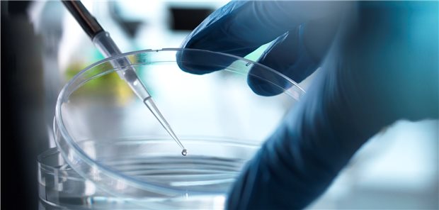 Bei etwa jedem vierten Patienten, bei dem etwa wegen einer Leukämie eine allogene Stammzelltransplantation erfolgt, kommt es zu einer Graft-versus-Host-Disease (GVHD).