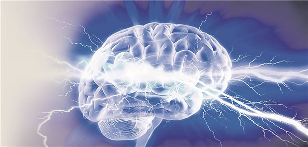 Bei etwa zwei Drittel der Patienten mit therapieresistenter Epilepsie gehen die Anfälle von einem umgrenzten Areal im Gehirn aus.