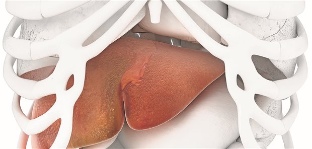 Bei fortgeschrittenem Leberkrebs ist eine Immuntherapie mit Nivolumab möglicherweise eine Option.