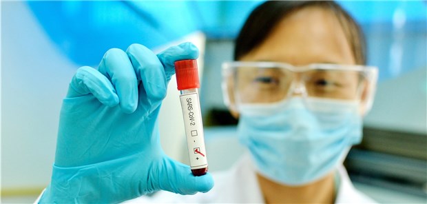 Coronavirus – was wir wissen und was nicht Bei großen Infektionswellen ist es besonders wichtig, das medizinische Personal zu schützen.