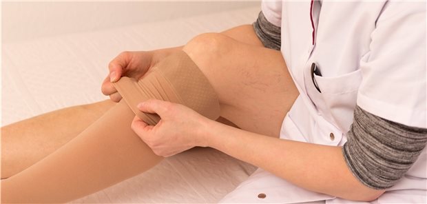 Bei individuell rezeptierten Kompressionsstrümpfen ist das Heimpersonal außen vor, wenn es die Behandlungspflege vertraglich ausgeschlossen hat.