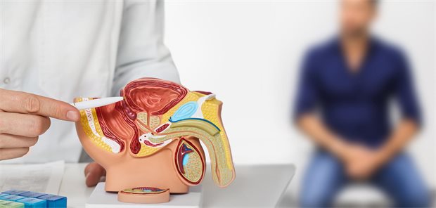 Arzt mit einem Modell des männlichen Harntrakts in der Hand spricht mit einem Patienten.