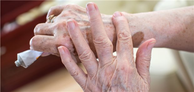 Bei topischen Anwendungen zur Schmerztherapie gibt es eine Reihe von Optionen.