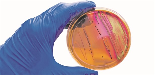 Bei unangemessener Antibiose können Erreger umfangreiche Resistenzen entwickeln.