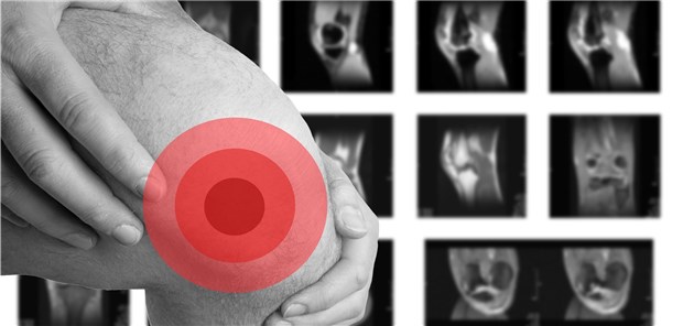 Bei vielen Patienten decken MRT-Bilder strukturelle Veränderungen im Knie offen. Doch nicht immer haben die Betroffenen auch Knieschmerzen.